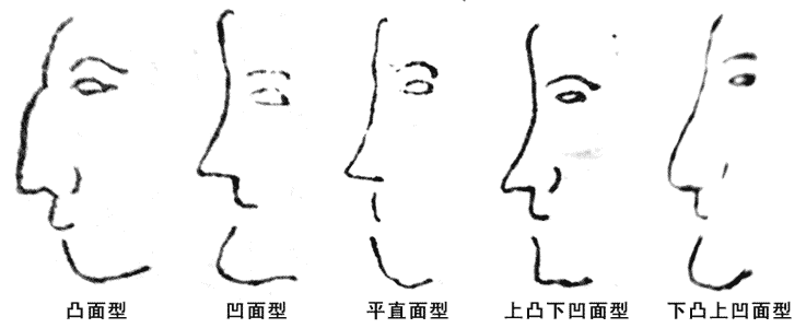 常见的五种侧面面型面相